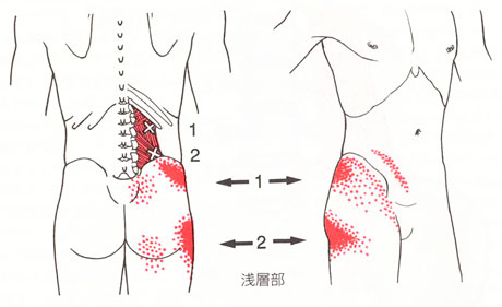 腰の痛みの図