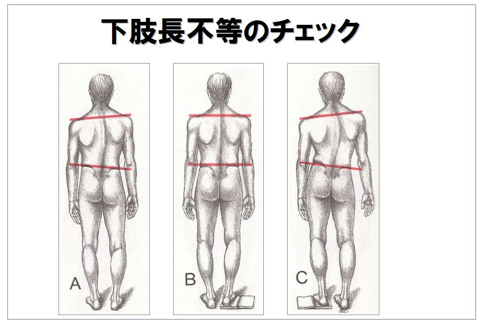 6 2 治りにくく再発しやすい要因 トリガーポイントとは 腰痛 肩こり 関節痛などの痛みの原因